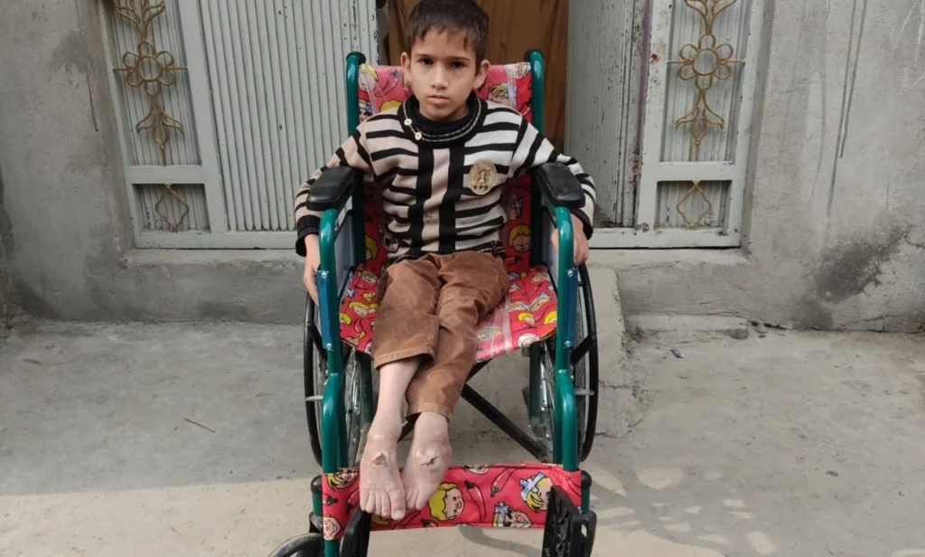 Ensuring Equal Opportunities for Persons with Disabilities in Pakistan