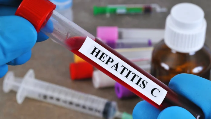 Hepatitis C Cases in Pakistan Reach 9.8 Million